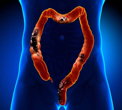 🌿 Deep Cleansing of Lymph – The Secret to a Healthier You